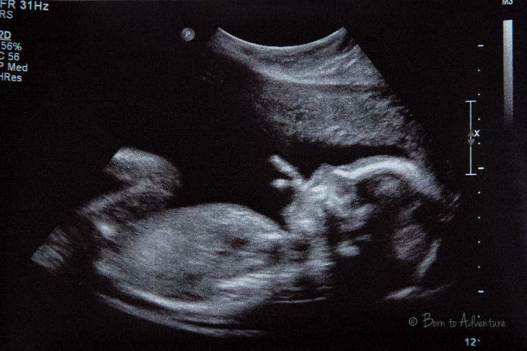 Baby Ultra Sound Picture